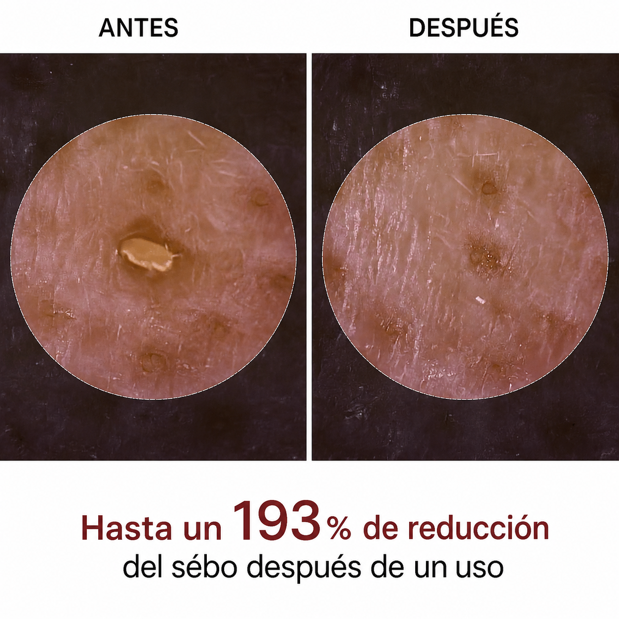 Peel Shot Coreano - Elimina las Impurezas y Sublima tu Piel