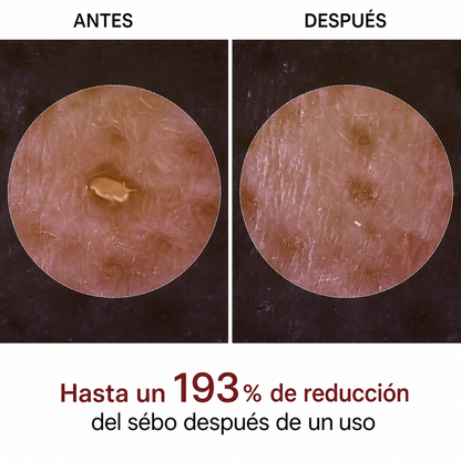 Peel Shot Coreano - Elimina las Impurezas y Sublima tu Piel