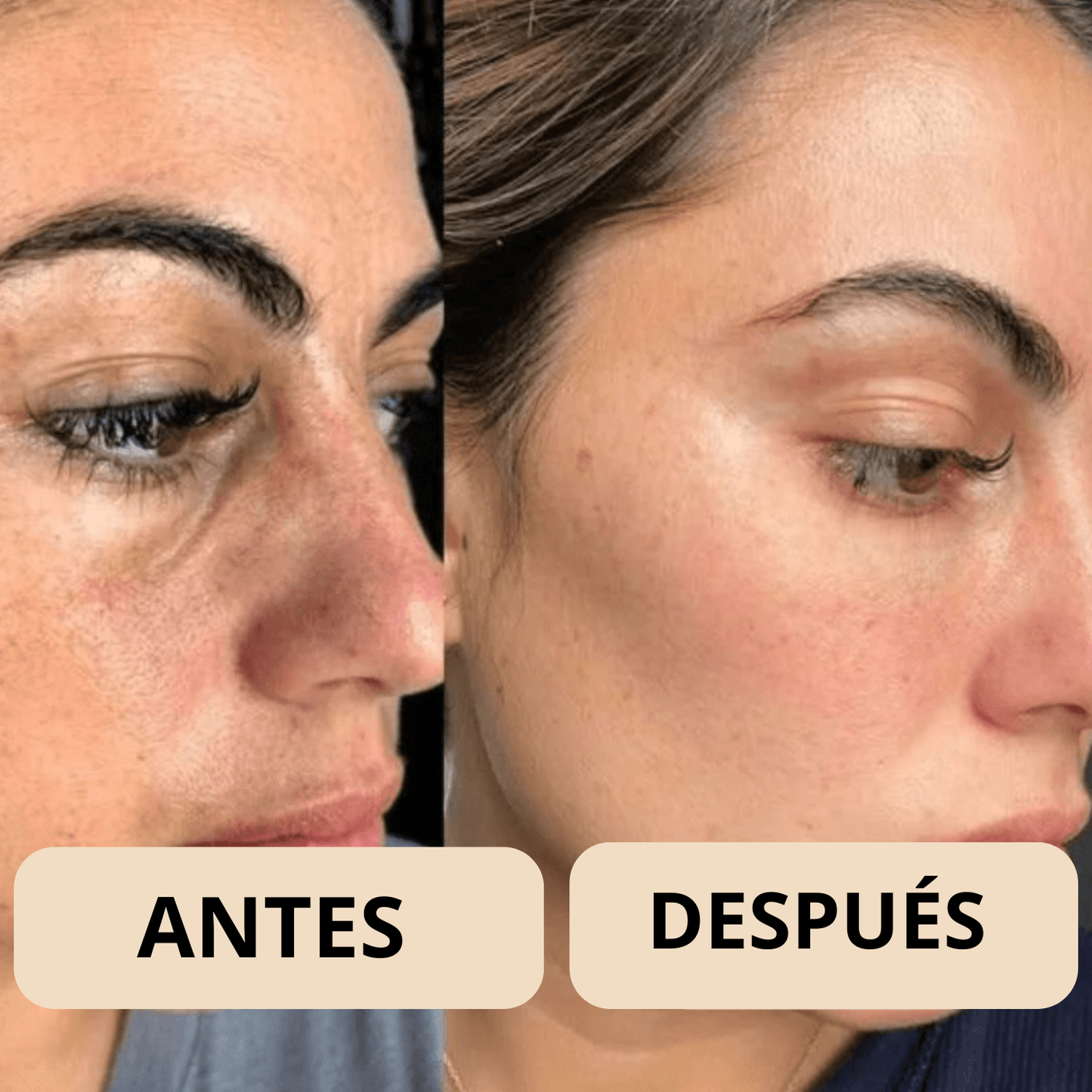 Peel Shot Coreano - Elimina las Impurezas y Sublima tu Piel