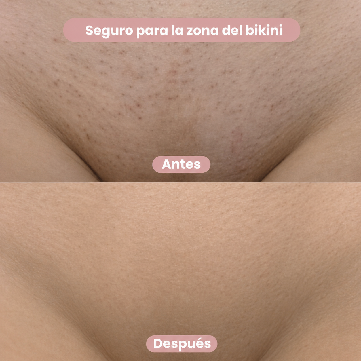 Seraskin™ – Depiladora 2 en 1 para Bikini y Cuerpo
