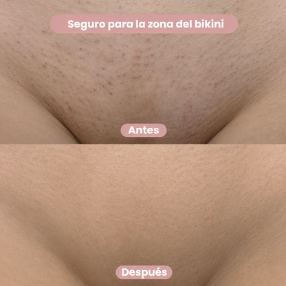 Seraskin™ – Depiladora 2 en 1 para Bikini y Cuerpo