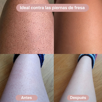 Seraskin™ – Depiladora 2 en 1 para Bikini y Cuerpo